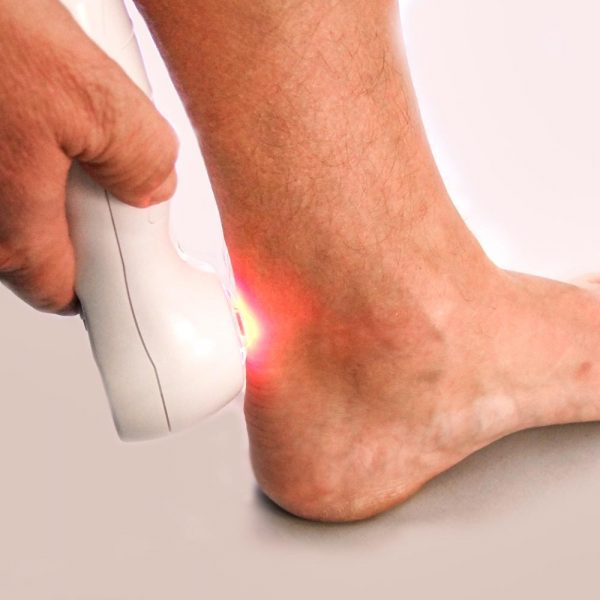 Handy Cure laserová biolampa – Zvyšuje cévní aktivitu